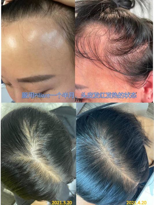 Biogency PILIANT 生髮靈 60粒 - La Fée Beauty