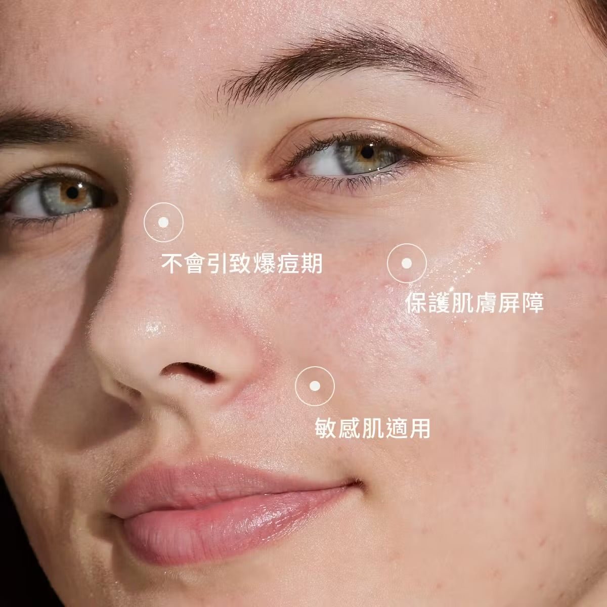 CAUDALIE 歐緹麗 葡萄籽淨化抗痘精華 30ML - La Fée Beauty