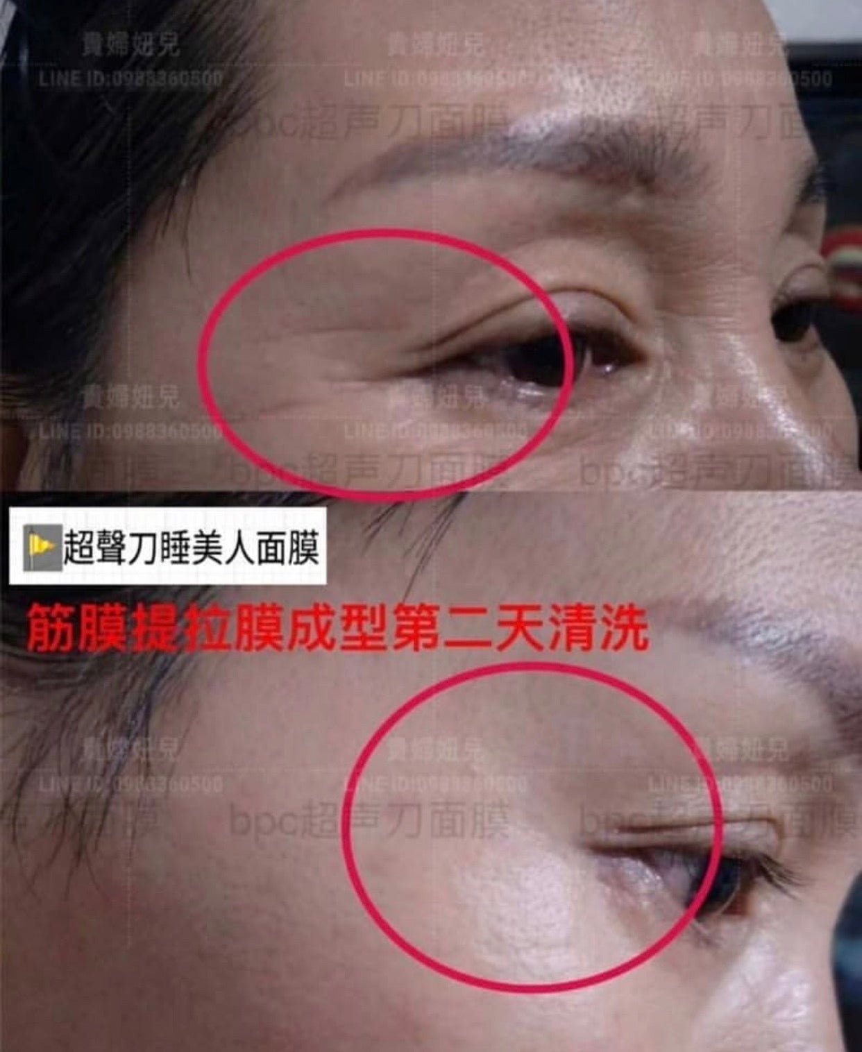 日本 BPC 新款 超聲刀睡美人 精華睡眠面膜 30粒 - La Fée Beauty