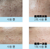 DERMATHOD O2 Tox Peel 骨針煥膚精華 30ml