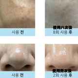 DERMATHOD O2 Tox Peel 骨針煥膚精華 30ml