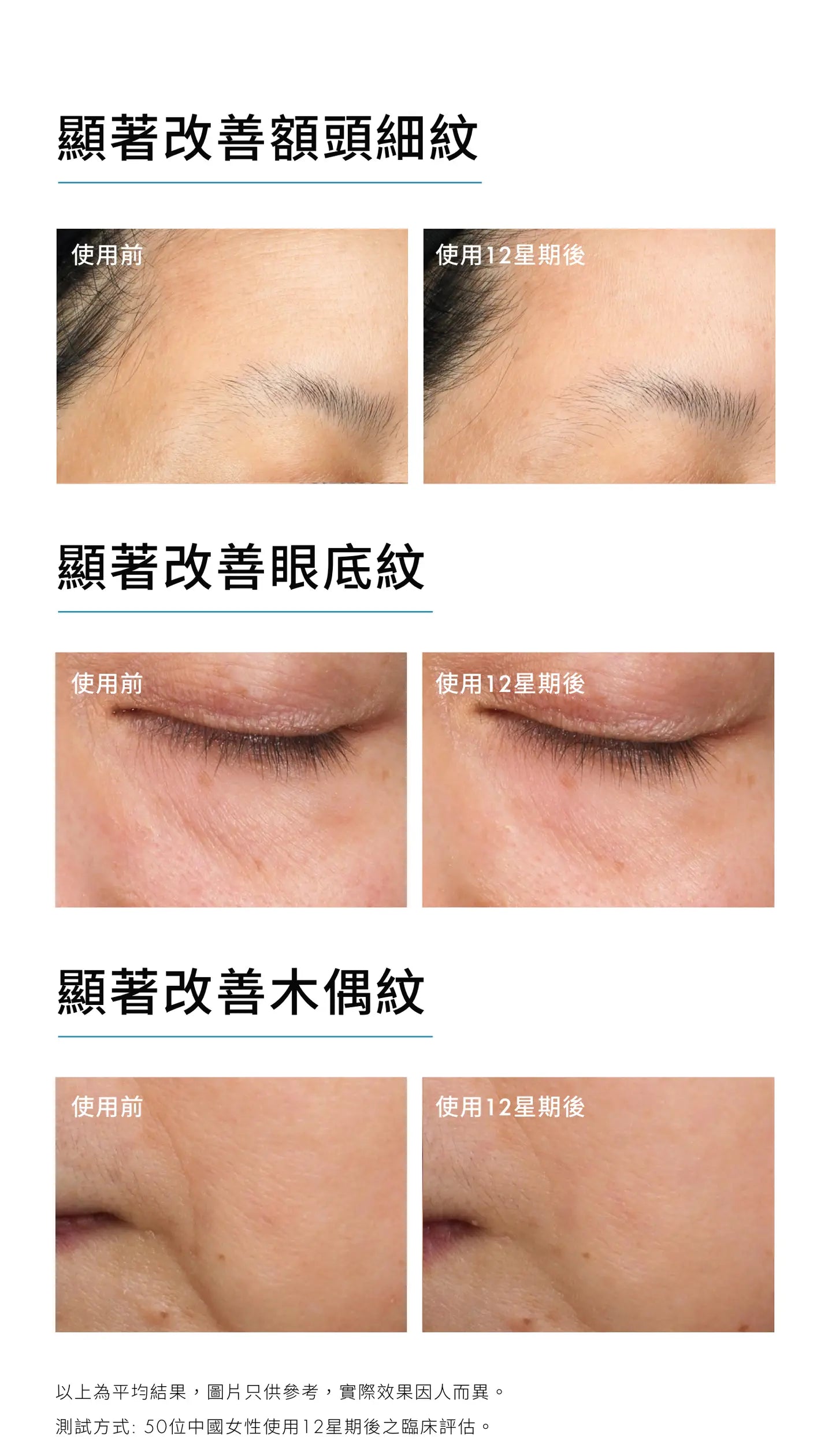 SkinCeuticals P-Tiox 胜肽抗皺精華