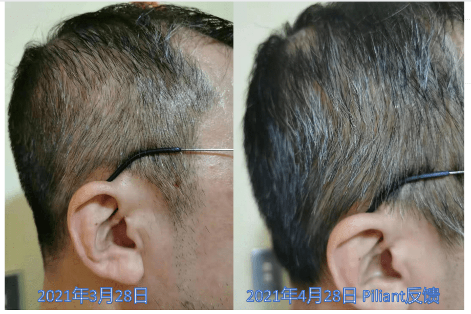 Biogency PILIANT 生髮靈 60粒 - La Fée Beauty