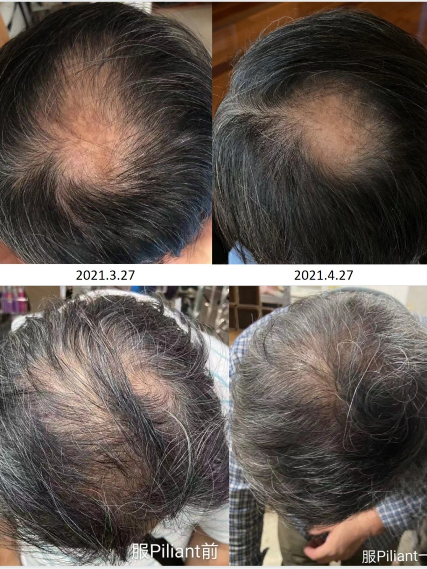 Biogency PILIANT 生髮靈 60粒 - La Fée Beauty