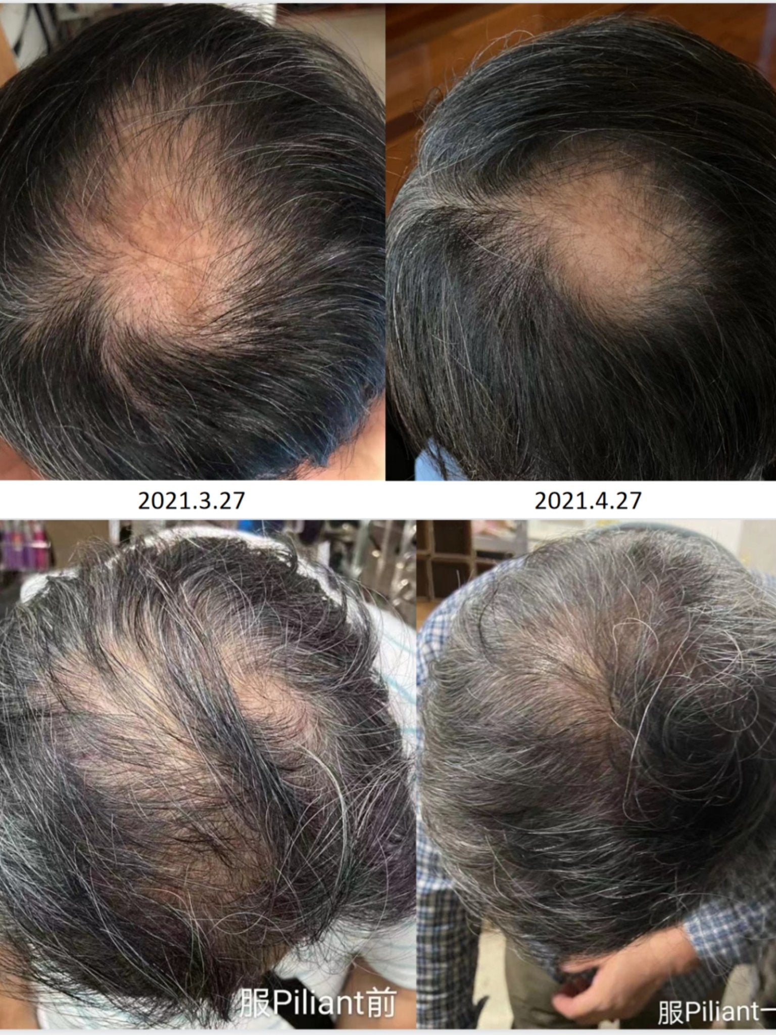 Biogency PILIANT 生髮靈 60粒 - La Fée Beauty