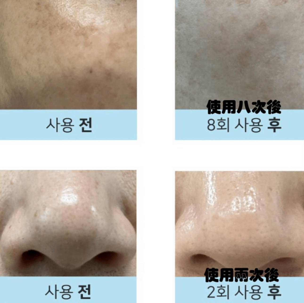 DERMATHOD O2 Tox Peel 骨針煥膚精華 30ml - La Fée Beauty