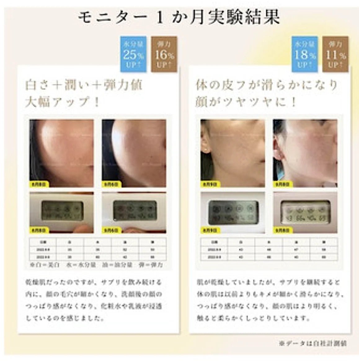 Dr. Watanabe Nomumin 鳳梨神經醯胺 1,050mg 30片 加強免疫力 - La Fée Beauty