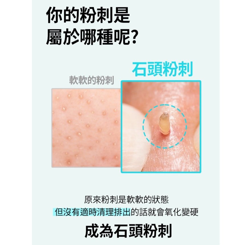 斷貨王 韓國ilso Super Melting Sebum Softener 黑頭粉刺導出液 + Deep Clean Master 黑頭鏟 - La Fée Beauty