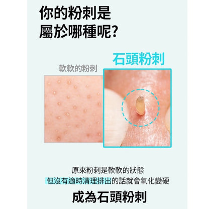 斷貨王 韓國ilso Super Melting Sebum Softener 黑頭粉刺導出液 + Deep Clean Master 黑頭鏟 - La Fée Beauty