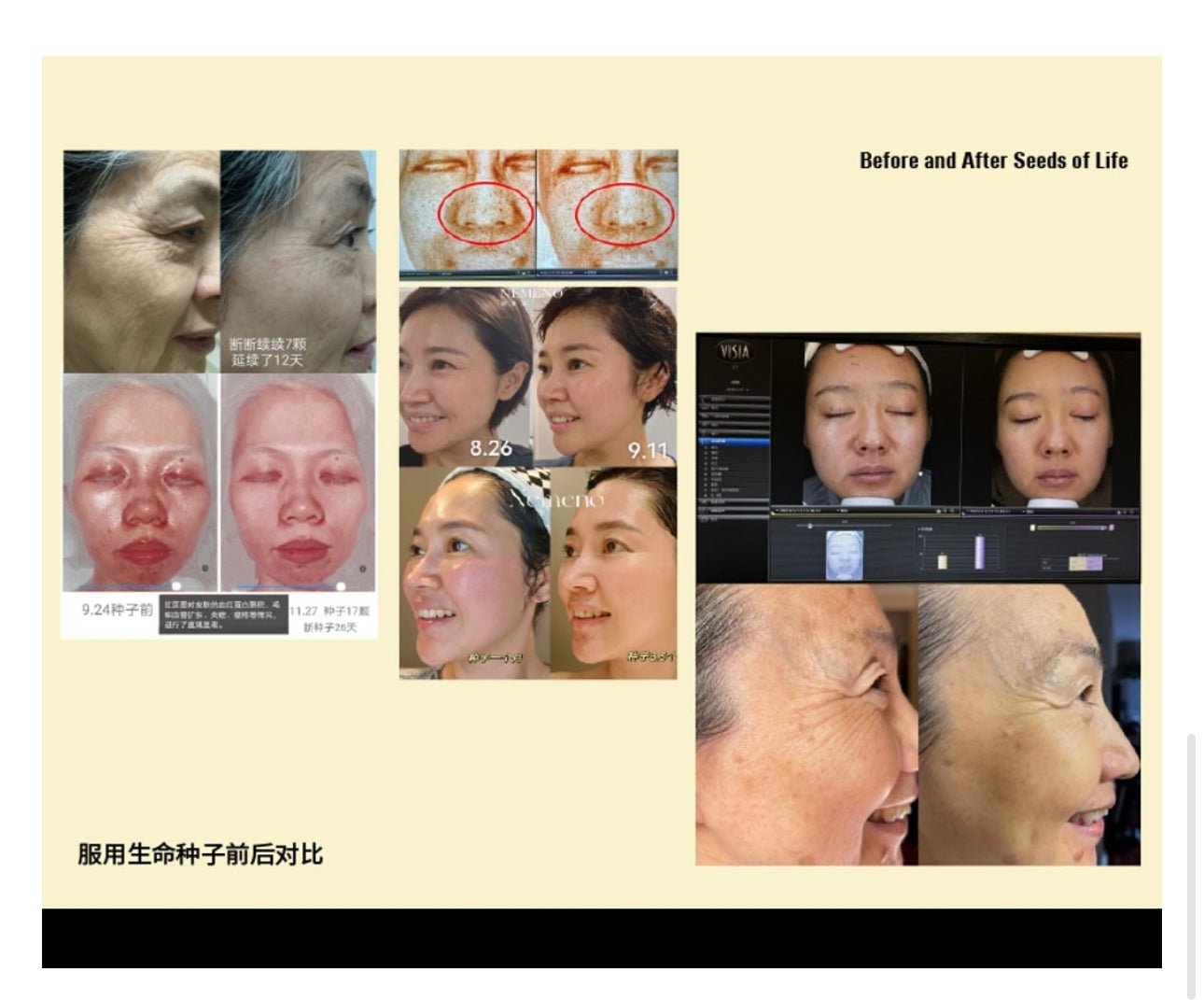 NEMENO 逆美諾 生命種子 口服 改善面部初老 內服藥片 30粒/一瓶 - La Fée Beauty