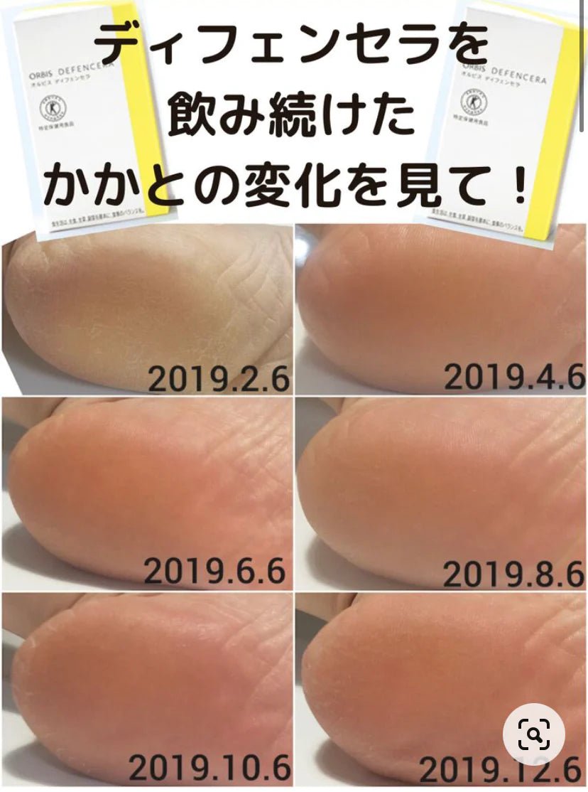 日本 ORBIS 神經酰胺保濕口服粉 30包 - La Fée Beauty
