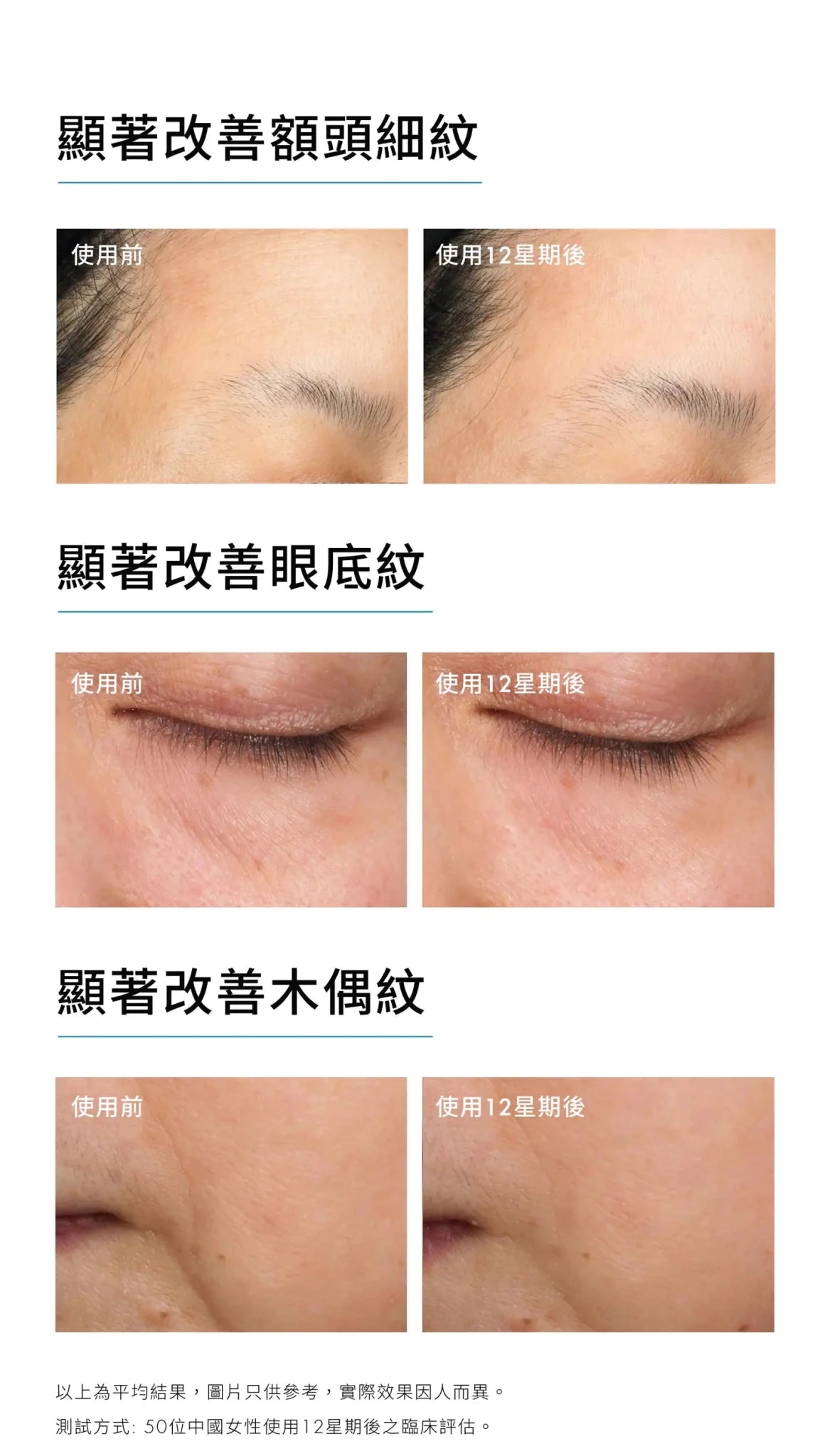SkinCeuticals P-Tiox 胜肽抗皺精華 - La Fée Beauty
