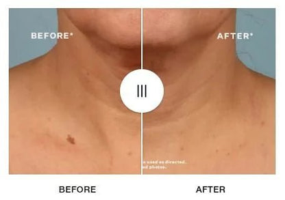 StriVectin 思薇婷 StriVectin TL Advanced™ Tightening Neck Cream PLUS 升級頸部緊緻精華霜 30ml - La Fée Beauty
