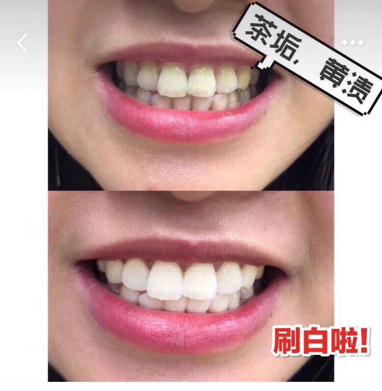日本直送 山田養蜂場藥用牙膏 100g - La Fée Beauty