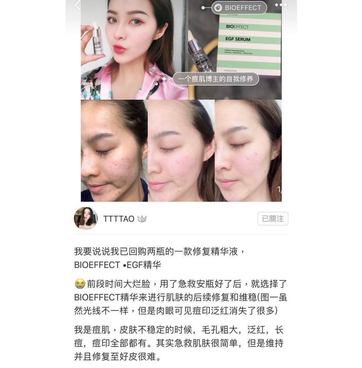 BIOEFFECT EGF Serum 益肌煥顏修護精華露 15ml - La Fée Beauty