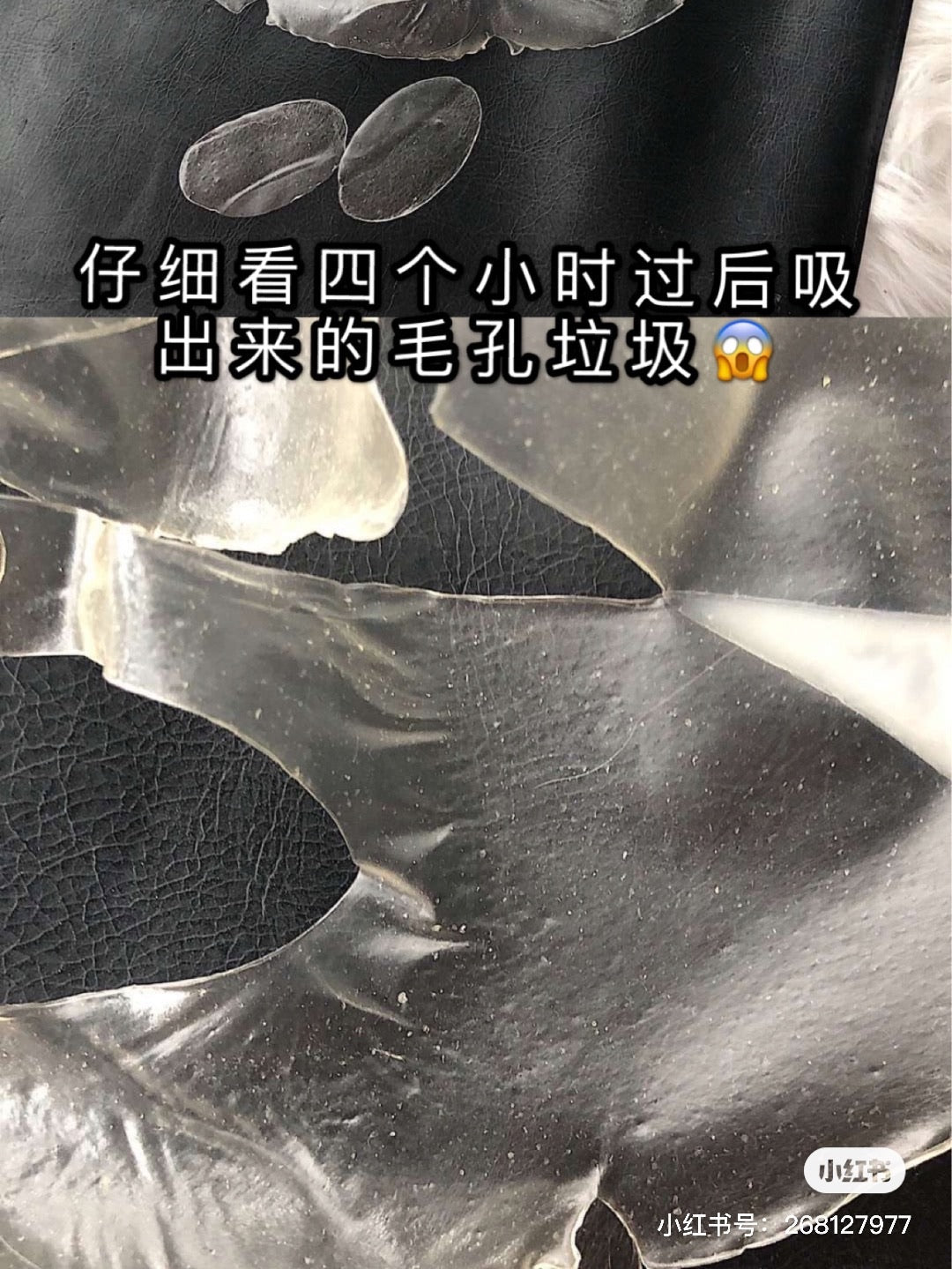 韓國 Dermall matrix 植物纖維ECM全效修復面膜 韓國人皮面膜 4片 - La Fée Beauty