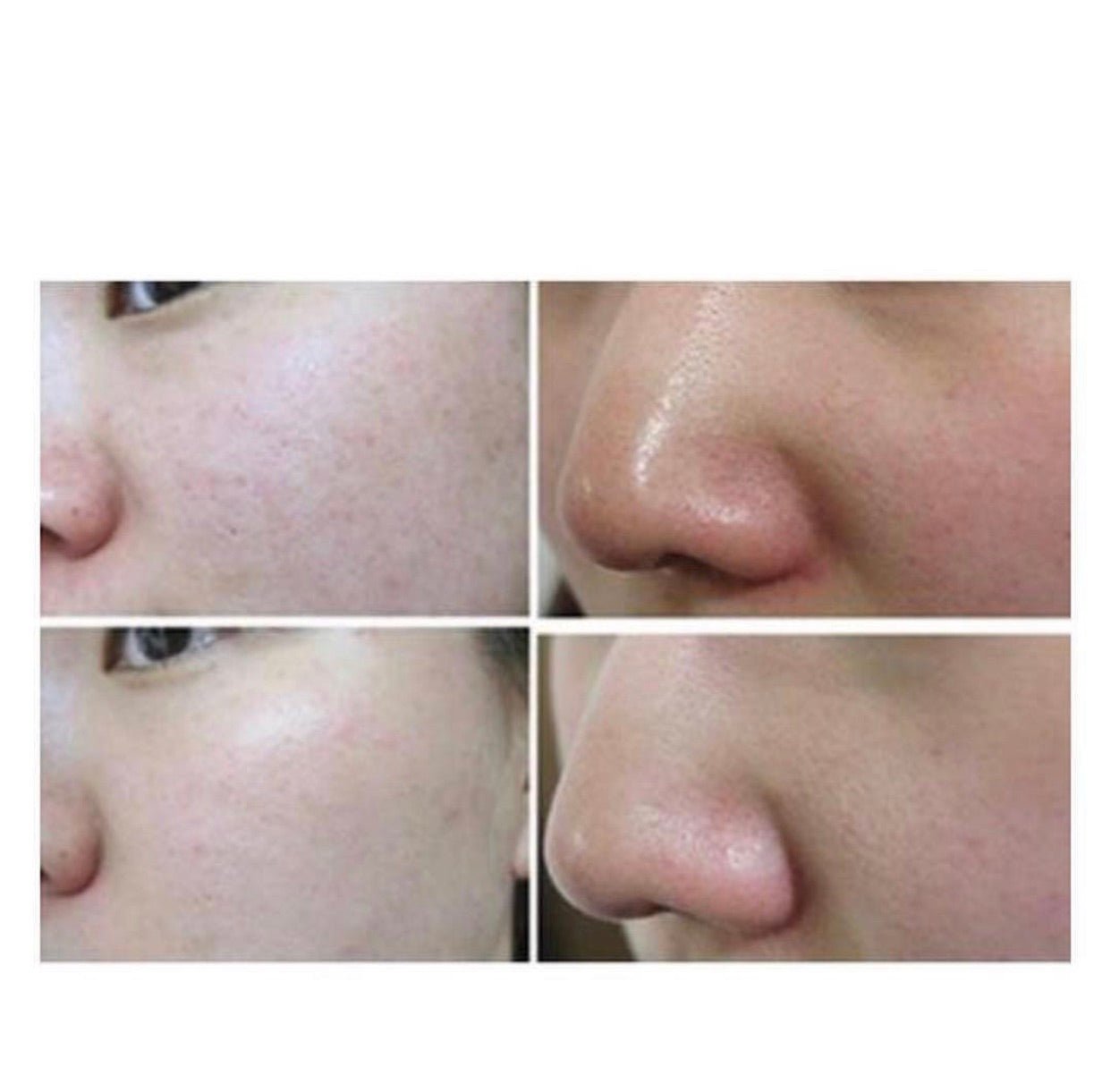 Dr.Ci:Labo 城野醫生 零毛孔潔面乳 120ML - La Fée Beauty