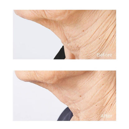 PERRICONE MD 冷潤頸霜緊致提拉 去頸紋美頸霜 Cold Plasma Plus+ Sub-D/Neck 59ml