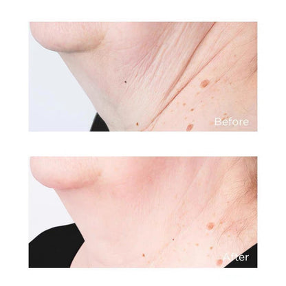 PERRICONE MD 冷潤頸霜緊致提拉 去頸紋美頸霜 Cold Plasma Plus+ Sub-D/Neck 59ml - La Fée Beauty