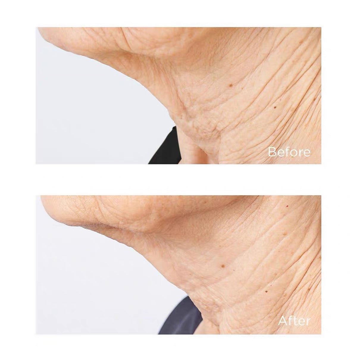 PERRICONE MD 冷潤頸霜緊致提拉 去頸紋美頸霜 Cold Plasma Plus+ Sub-D/Neck 59ml - La Fée Beauty