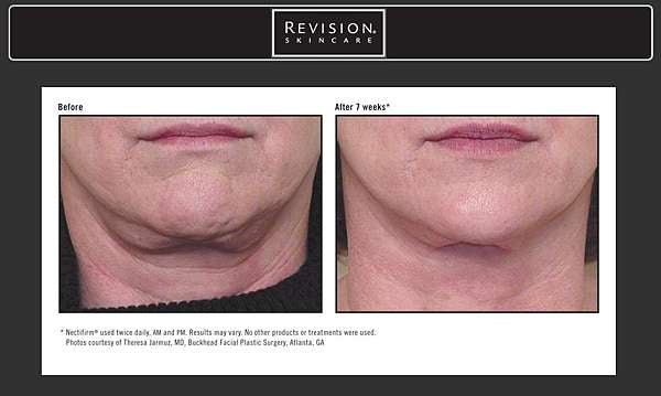 美國 Revision Nectifirm去皺緊緻滋潤頸霜 48g - La Fée Beauty