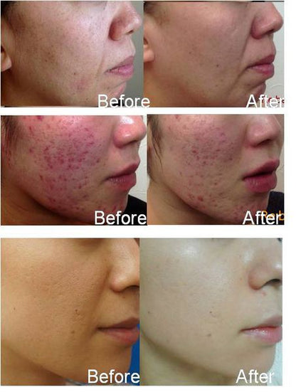 韓國 tHermoceutical - FCR 珊瑚鈣煥膚 陶瓷肌 - La Fée Beauty
