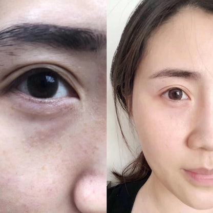 新加坡 Timeless Tomato 時光蕃茄美白丸 30日 - La Fée Beauty