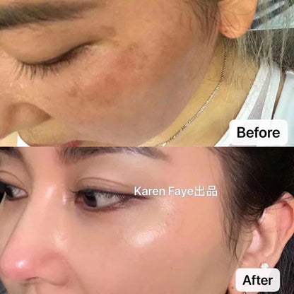 新加坡 Timeless Tomato 時光蕃茄美白丸 30日 - La Fée Beauty